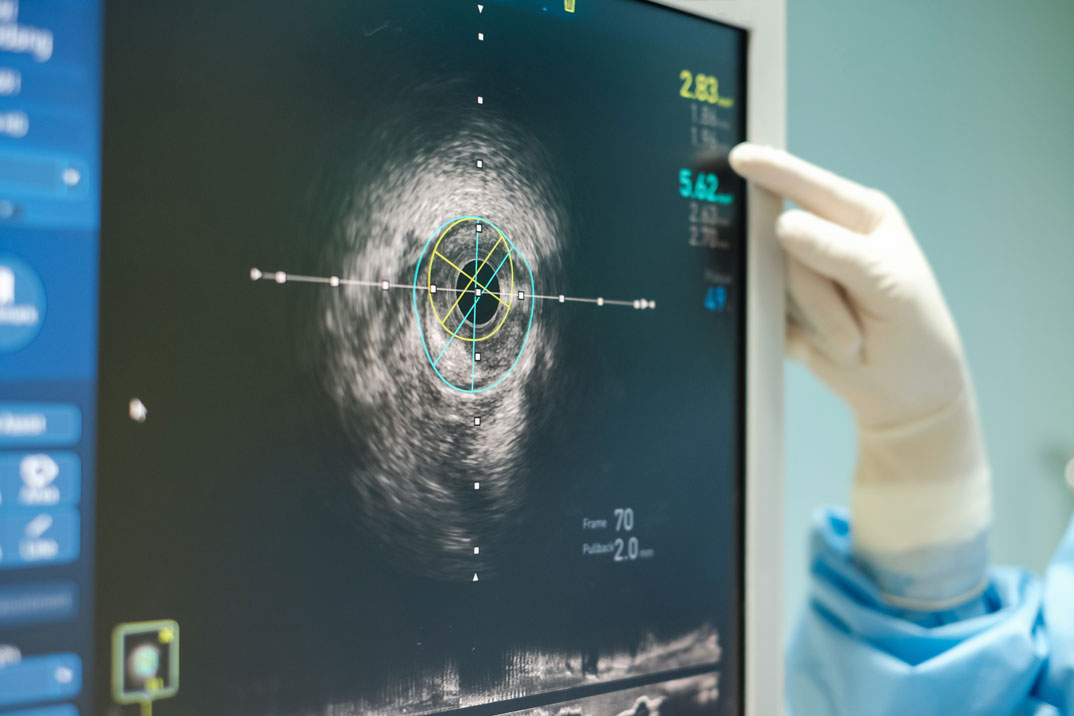 Ultrasound Technologist